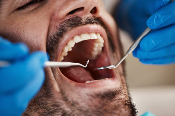 Best Weekend Emergency Dentist in Bourbon, IN