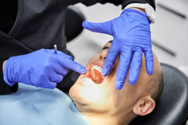 Best Emergency Broken Tooth Repair in Bourbon, IN