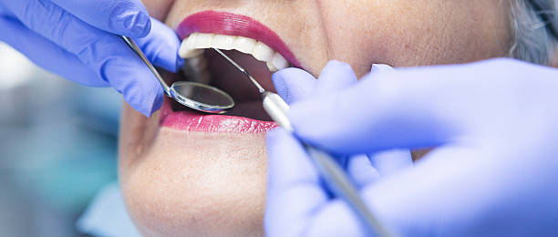 Best Emergency Dental Care for Trauma or Injury in Bourbon, IN